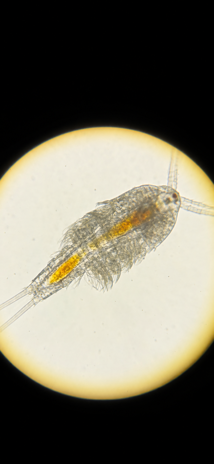 Enhanced microscope image of Tigriopus californicus copepod